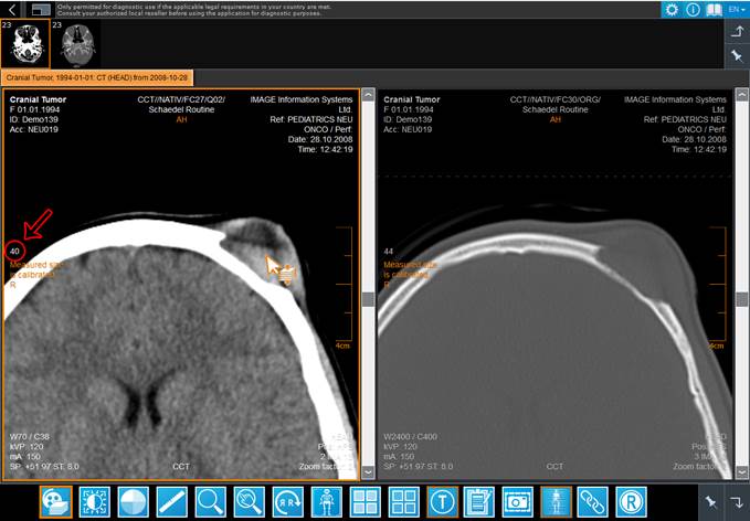 iQ-4VIEW - how to see tissue density in CT images under the mouse pointer